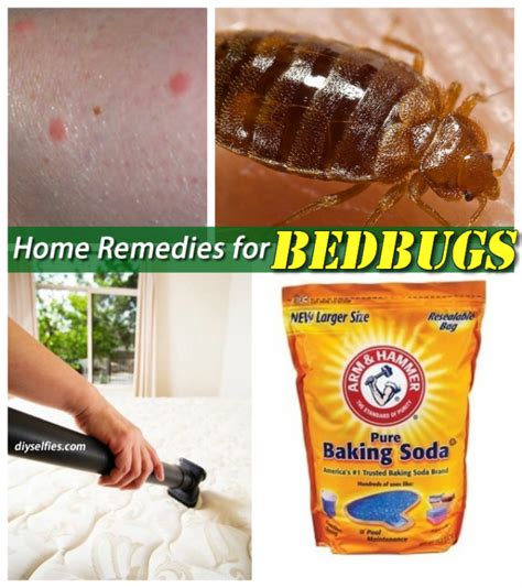 treatment for bed bugs bloomingdale|How to Get Rid of Bed Bugs Safely and Effectively.